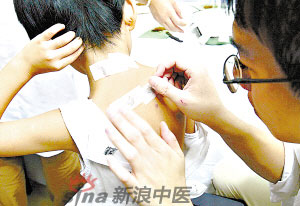 灸法的種類  你知道多少？