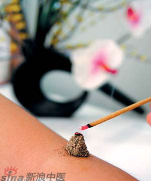節(jié)氣灸” 冬至，你灸了嗎？