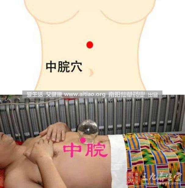 中脘穴位于腹部正中線，臍上4寸的位置上。每天艾灸10-15分鐘，能有效緩解胃部不適的癥狀，同時有助于祛濕。